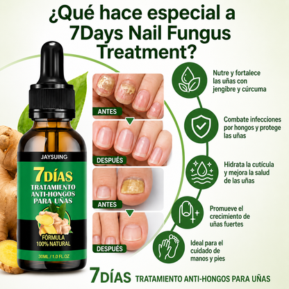TRATAMIENTO ANTIHONGOS PARA UÑAS 100% NATURAL