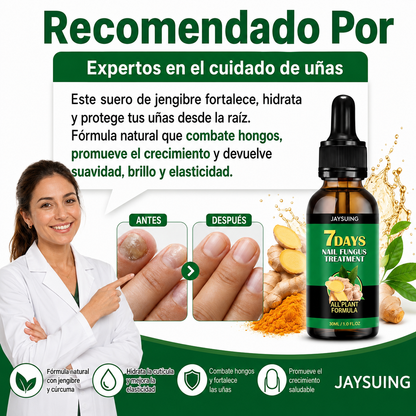 TRATAMIENTO ANTIHONGOS PARA UÑAS 100% NATURAL