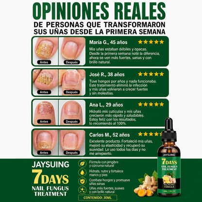 TRATAMIENTO ANTIHONGOS PARA UÑAS 100% NATURAL